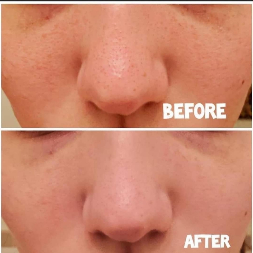 Mary Kay Microdermabrasion Plus set